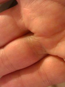 Copper in a ring turns finger green.